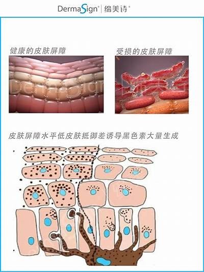 甜蜜生活记录：糖心Vlog探秘色斑与护肤秘籍官网分享